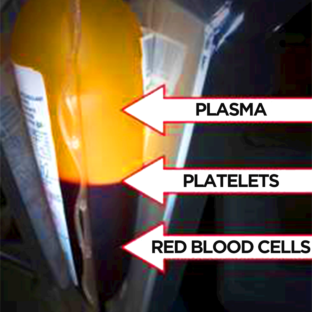 LifeServe_Transfusion Guidelines_9.3_IMG10