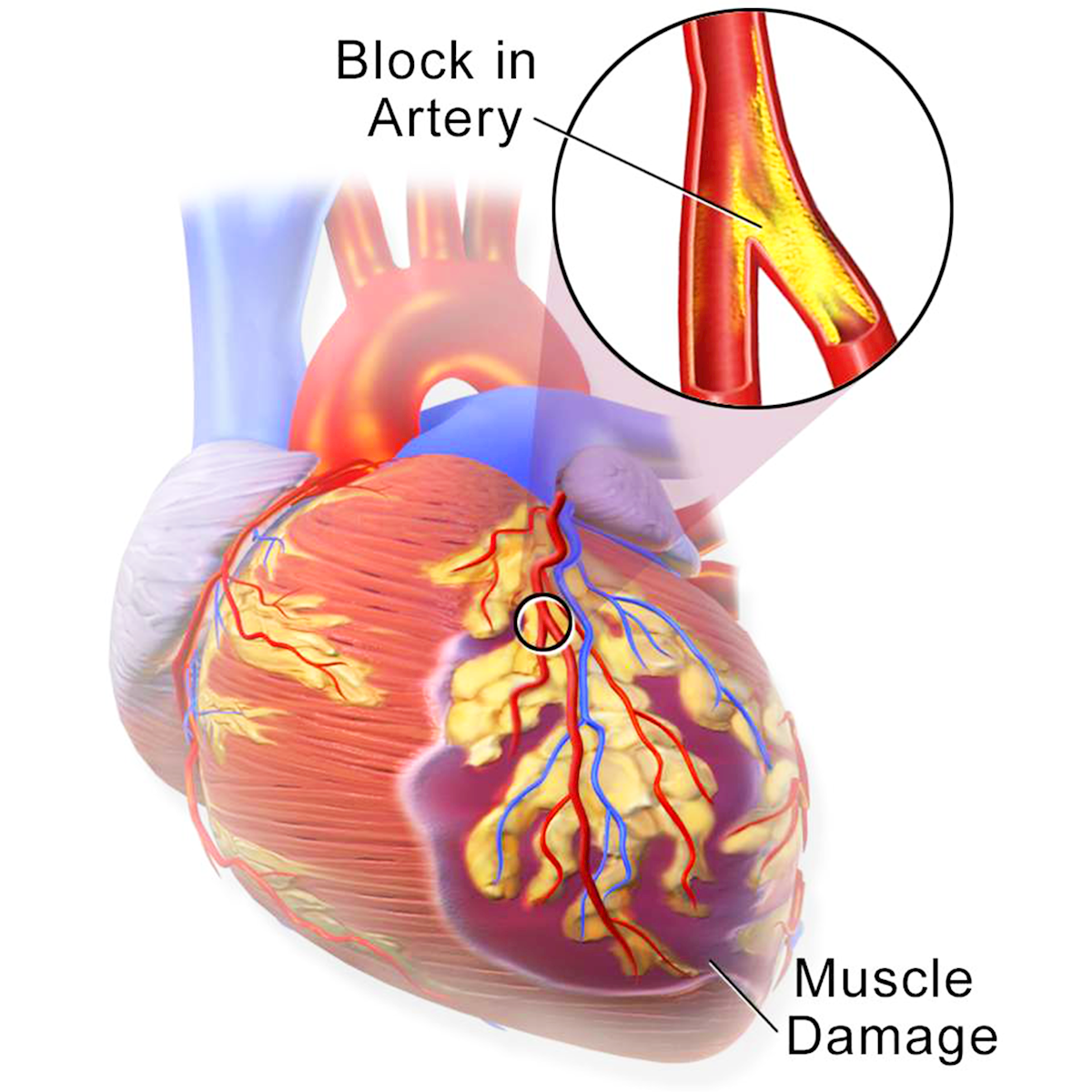 LifeServe_Transfusion Guidelines_9.3_IMG21