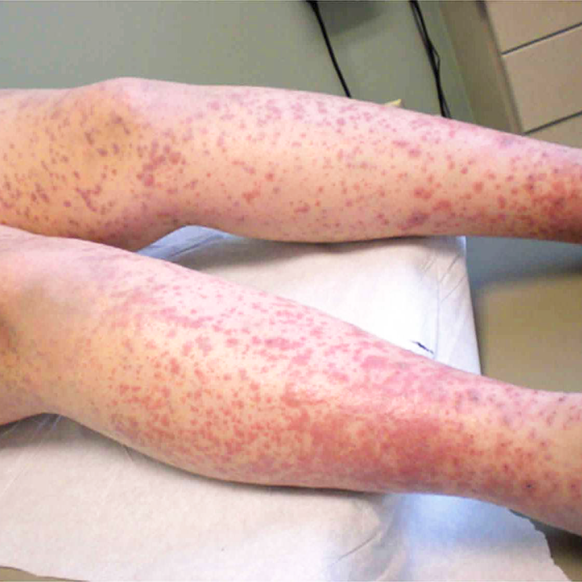 LifeServe_Transfusion Guidelines_9.3_IMG24