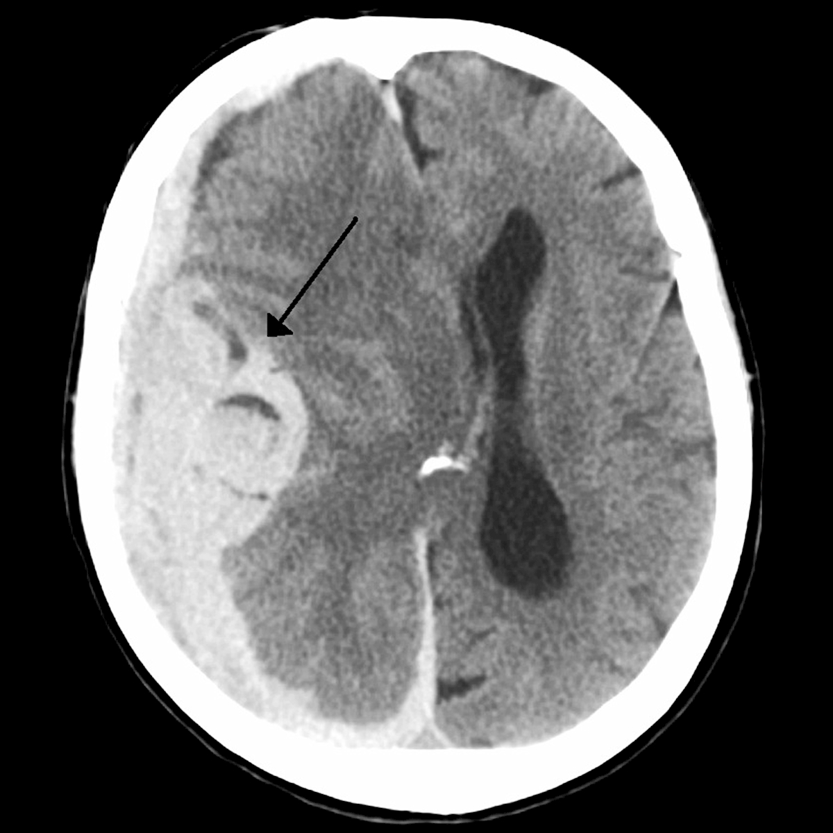 LifeServe_Transfusion Guidelines_9.3_IMG27