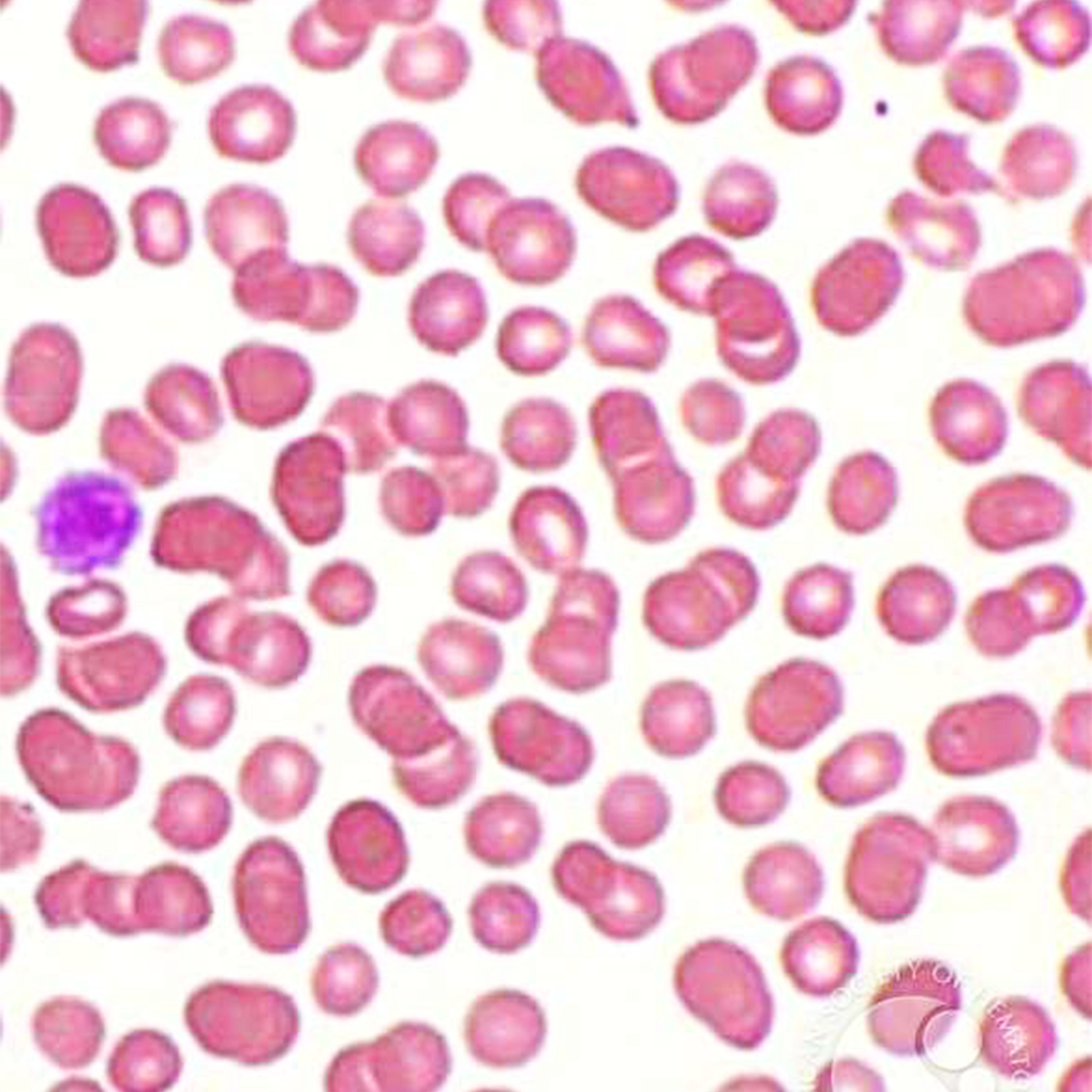 LifeServe_Transfusion Guidelines_9.3_IMG28