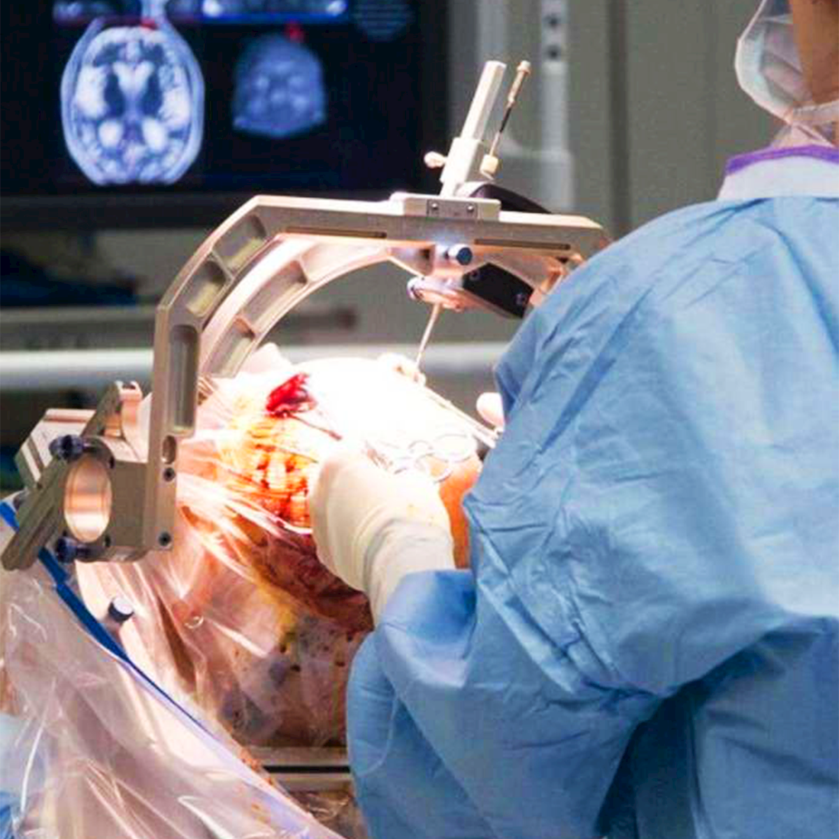 LifeServe_Transfusion Guidelines_9.3_IMG29