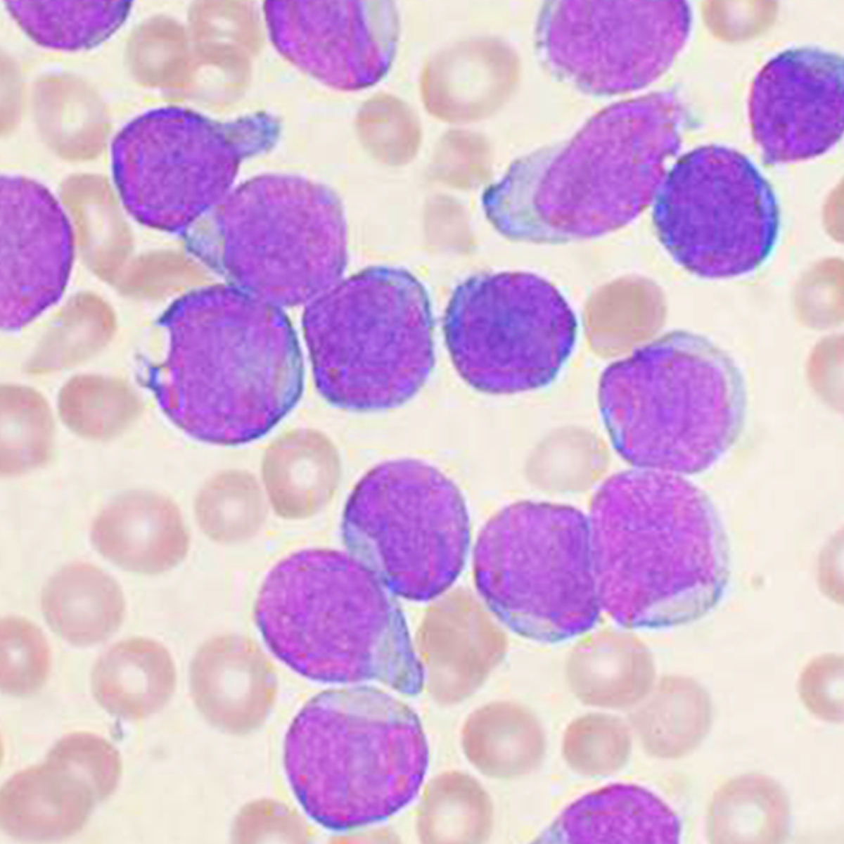 LifeServe_Transfusion Guidelines_9.3_IMG32