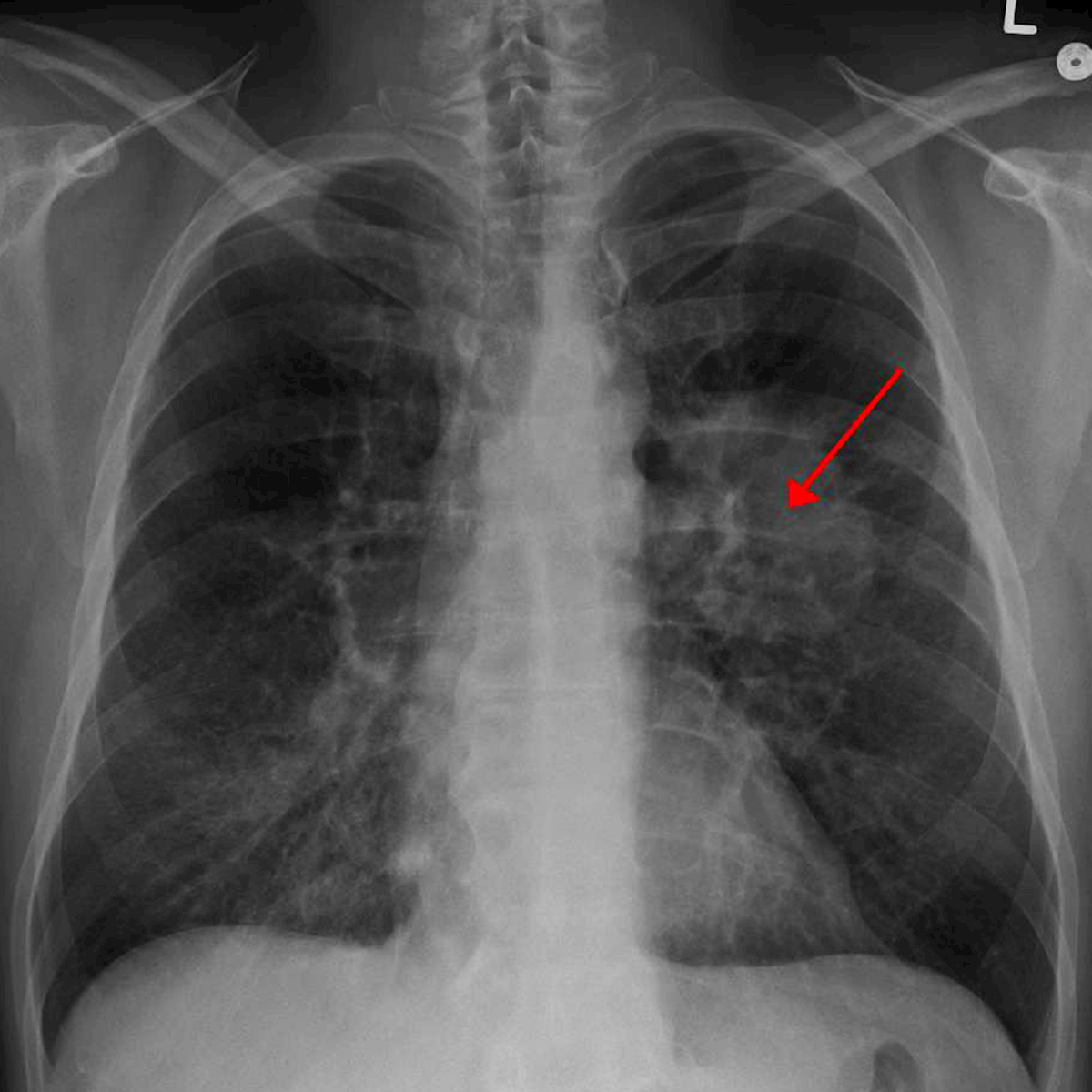 LifeServe_Transfusion Guidelines_9.3_IMG33
