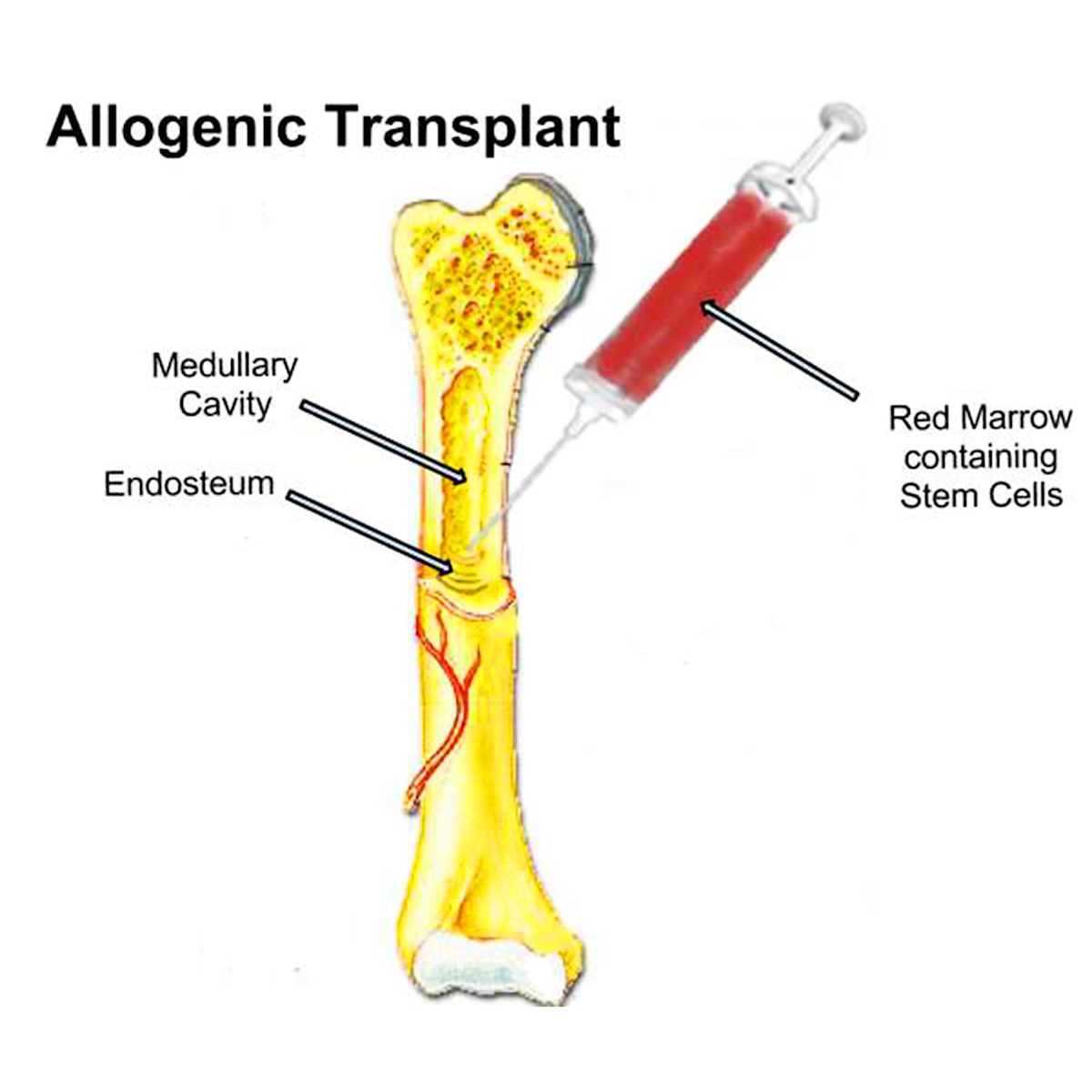 LifeServe_Transfusion Guidelines_9.3_IMG34