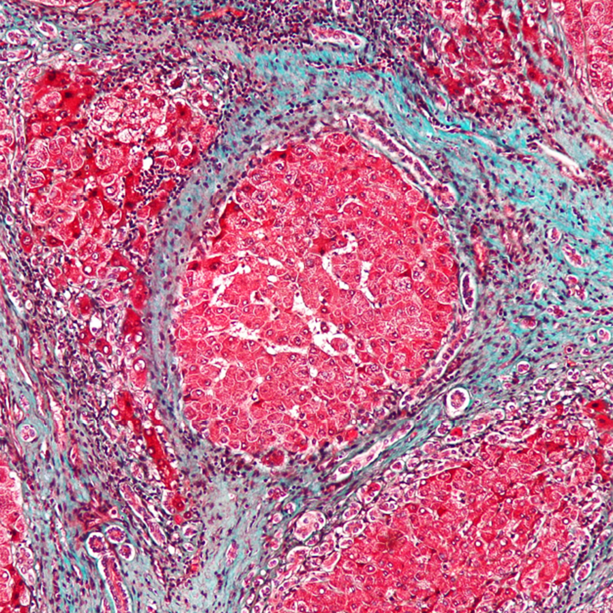 LifeServe_Transfusion Guidelines_9.3_IMG36