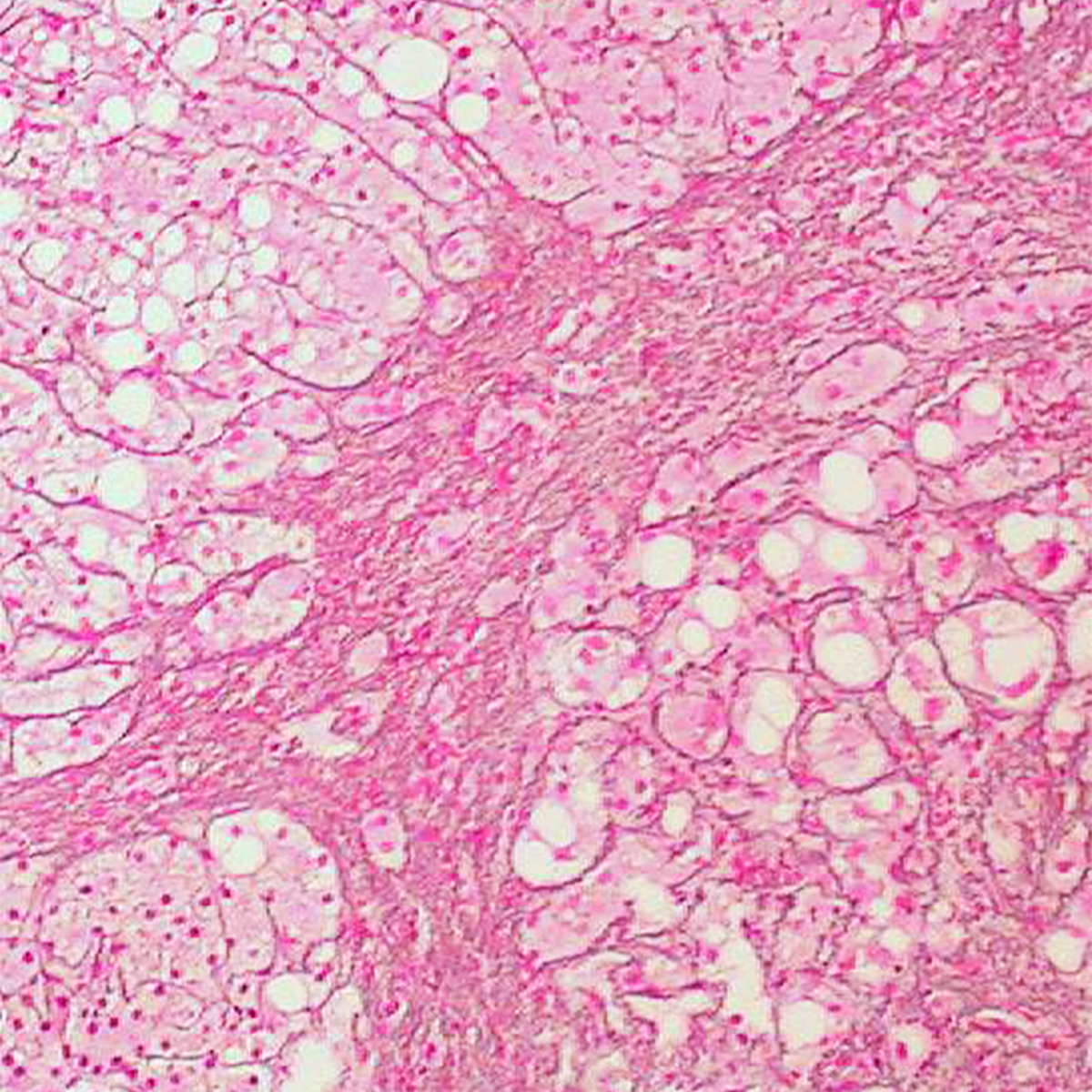 LifeServe_Transfusion Guidelines_9.3_IMG42
