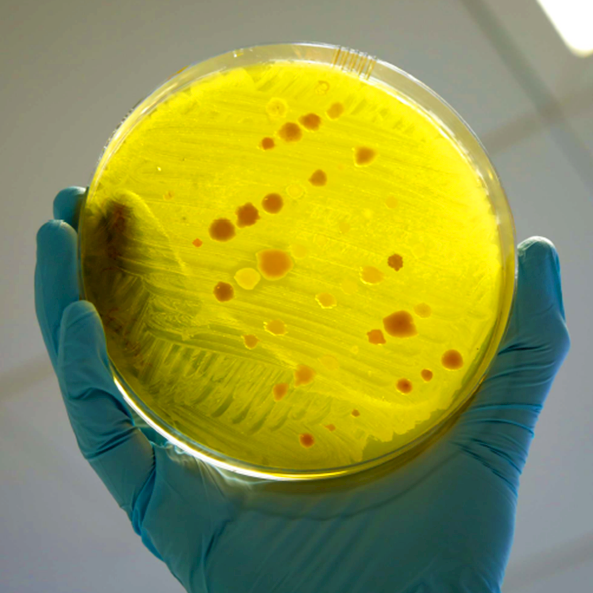 LifeServe_Transfusion Guidelines_9.3_IMG48