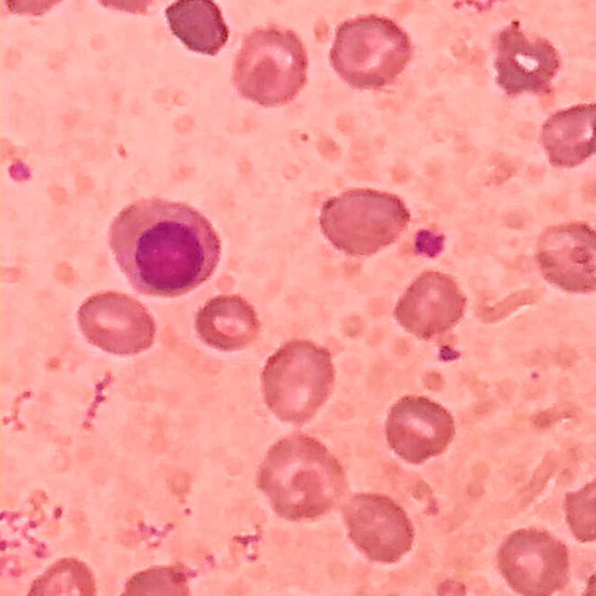 LifeServe_Transfusion Guidelines_9.3_IMG50