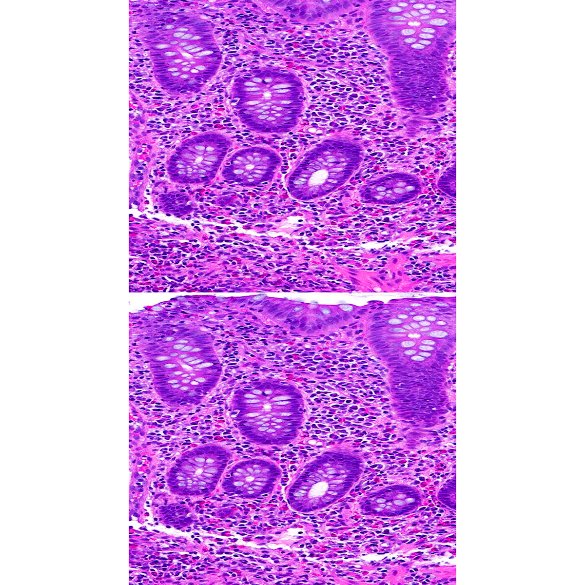 LifeServe_Transfusion Guidelines_9.3_IMG51