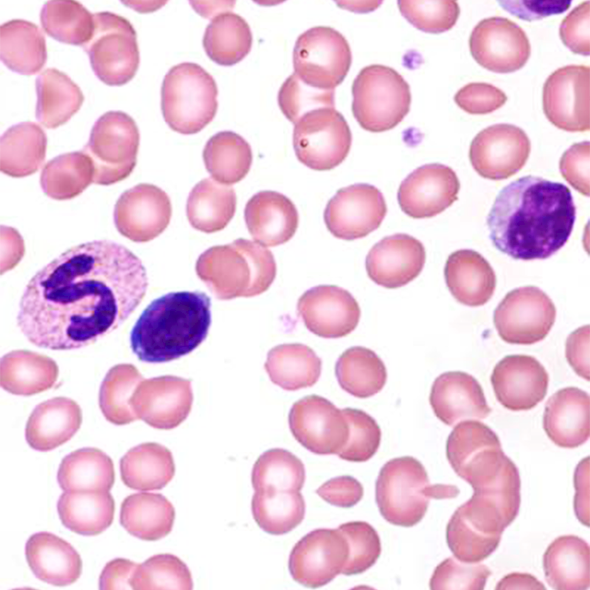 LifeServe_Transfusion Guidelines_9.3_IMG53