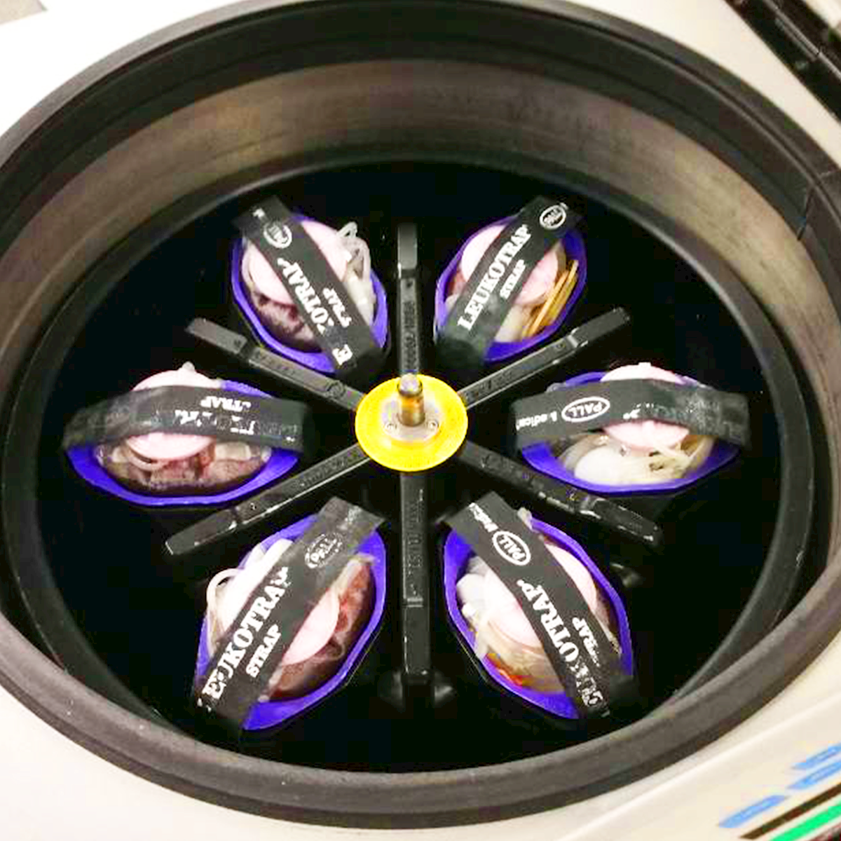 LifeServe_Transfusion Guidelines_9.3_IMG9